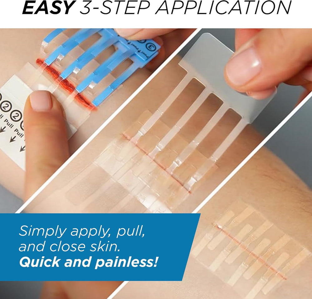 Clozex Emergency Laceration Kit - Repair Wounds Without Stitches, Skin Closur...