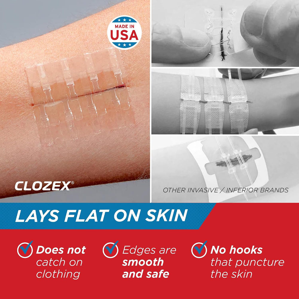 Clozex Emergency Laceration Kit - Repair Wounds Without Stitches, Skin Closur...